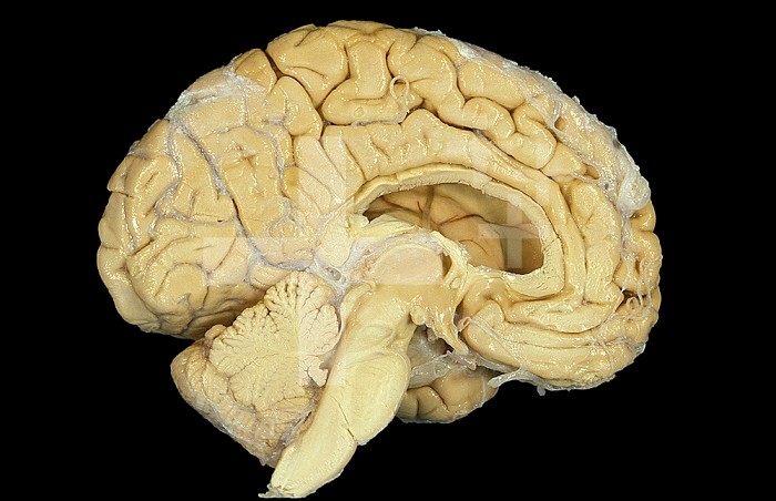 Midsagittal section of the human brain. Some of the main regions of the brain are the cerebrum, cerebellum, corpus callosum, pons, medulla oblongata, and brainstem.