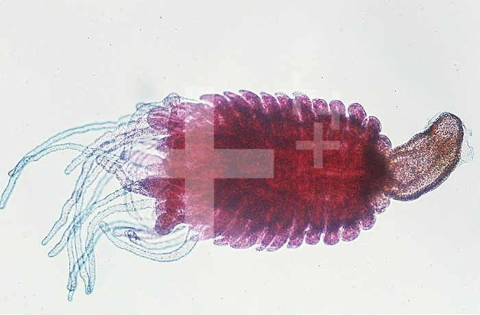 Jellyfish embryology (Aurelia) stobila, LM X35.