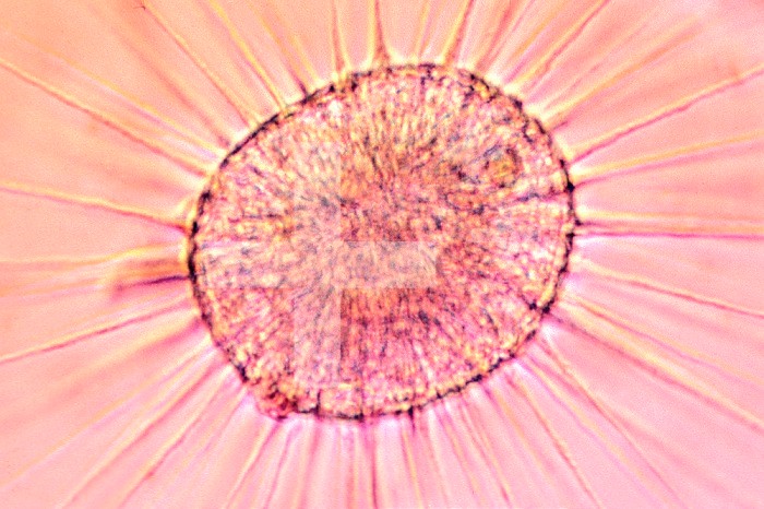 Heliozoan ,Actinosphaerium eichorni, Protozoa showing pseudopods extending through shell. DIC, LM X310.