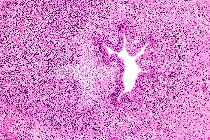 Urethra lined by stratified columnar urothelium within the corpora spongiosum in a human infant penis, H&E stain. LM X26