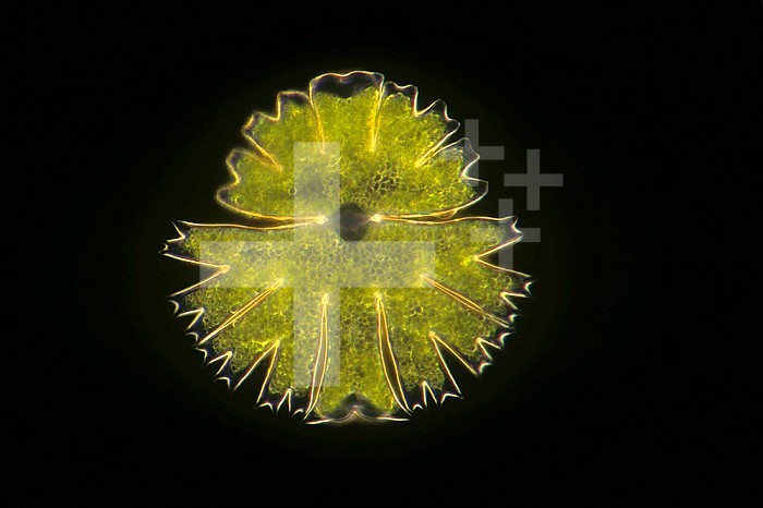 Freshwater Green Algae like Micrasterias are called Desmids. Darkfield, LM X100.