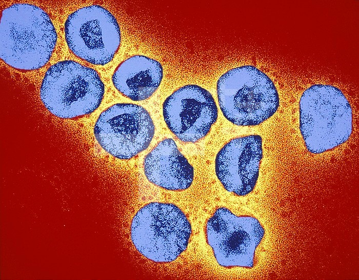 Corona Virus, a cause of the common cold. TEM X409,500