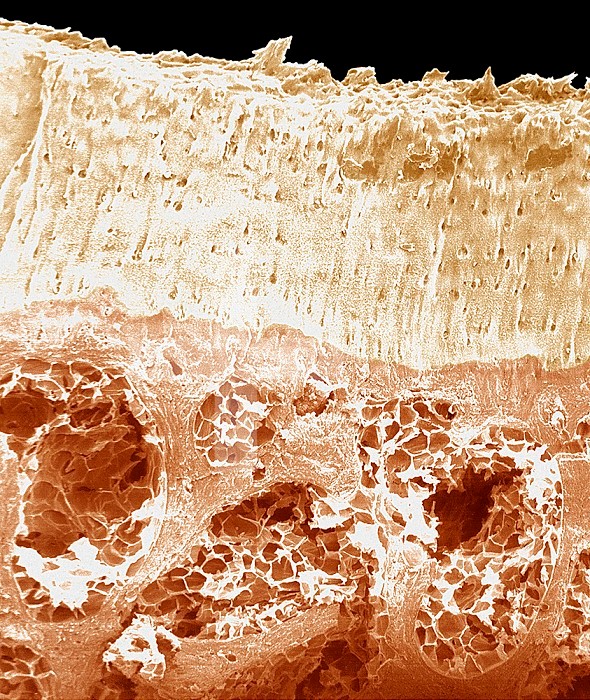 Human bone articular surface cross-section. SEM X91.
