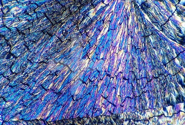 Cholesterol crystals viewed in polarized light. LM X55.