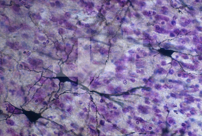 Purkinje cells of the cerebellum of the brain. X60