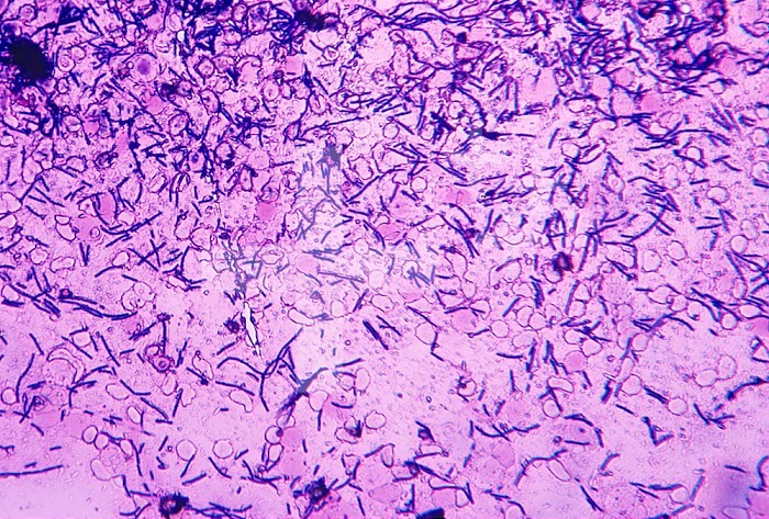 Anthrax Bacteria (Bacillus anthracis). LM X300