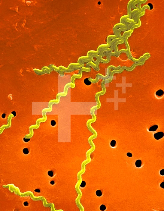 Leptospira interrogans is a spiral-shaped Bacteria seen on a membrane filter. SEM