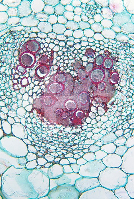 Cabbage Black Rot showing Xanthomonas campestris Bacteria in the vascular bundles. LM X65.