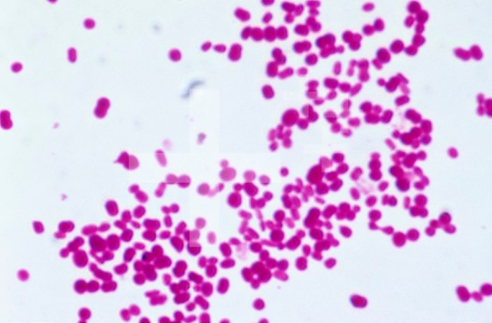 Streptococcus pneumoniae Bacteria, one of the pathogens for pneumonia and other human diseases. Brightfield, LM X800.