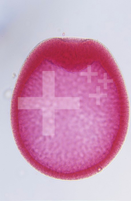 Starfish embryology, blastula stage. LM X300.