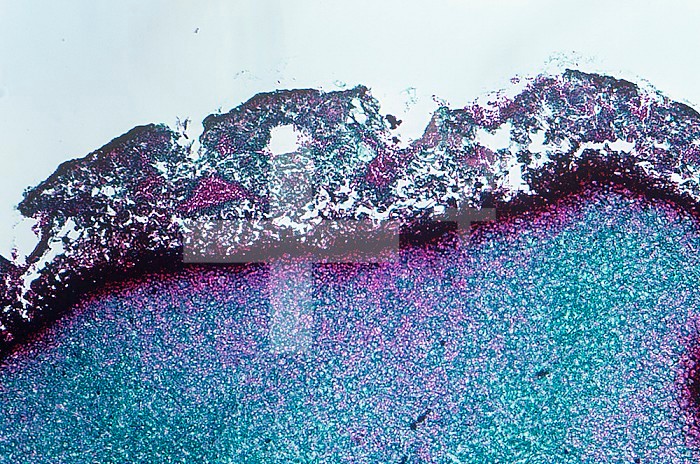 Cross-section of Claviceps purpurea Fungus mature sclerotium. LM X30.
