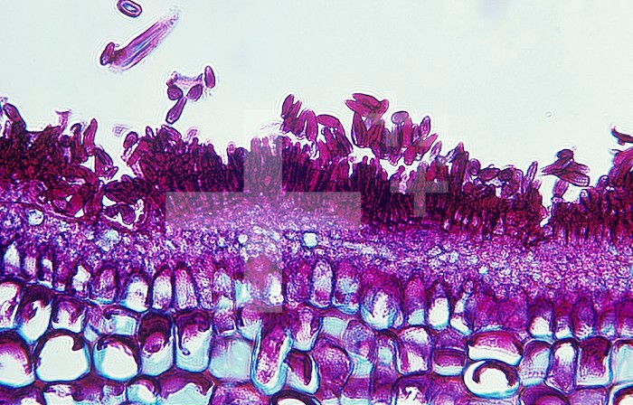 Cross-section of the Scab Fungus (Venturia inaequalis) conidia on an Apple fruit. LM X80.
