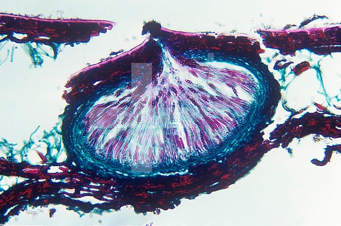 Cross-section of a leaf infected by the Leaf Blotch Fungus (Leptosphaeria), showing ascigerous stroma, Ascomycota. LM X80.