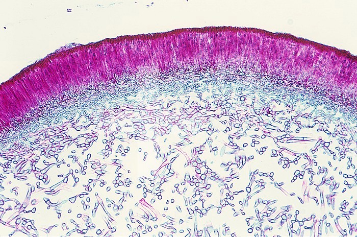 Cross-section of a Foliose Lichen fruiting body (Peltigera). LM X30.