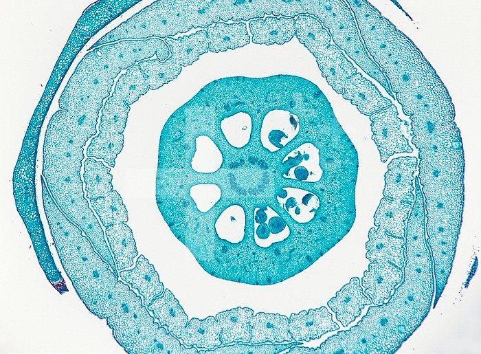 Cross-section of the floral bud through the ovary of the Lemon (Citrus limon). LM X4.