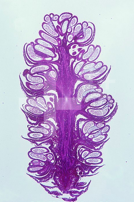 Longitudinal section of the floral bud of a male Alder (Alnus). LM X4.
