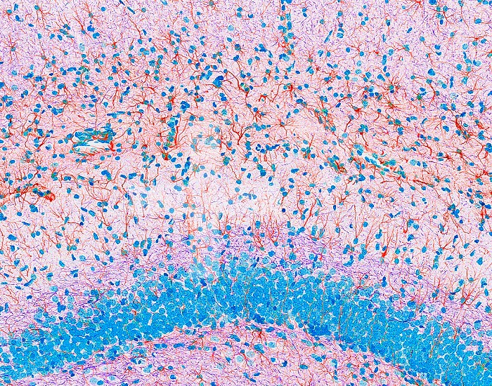 Sections of mammal hippocampus stained with various cellular markers. 2-photon fluorescence microscopy