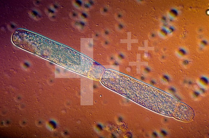 Gregarine parasitic Protozoa sporonts in asexual reproduction. DIC, LM X100.