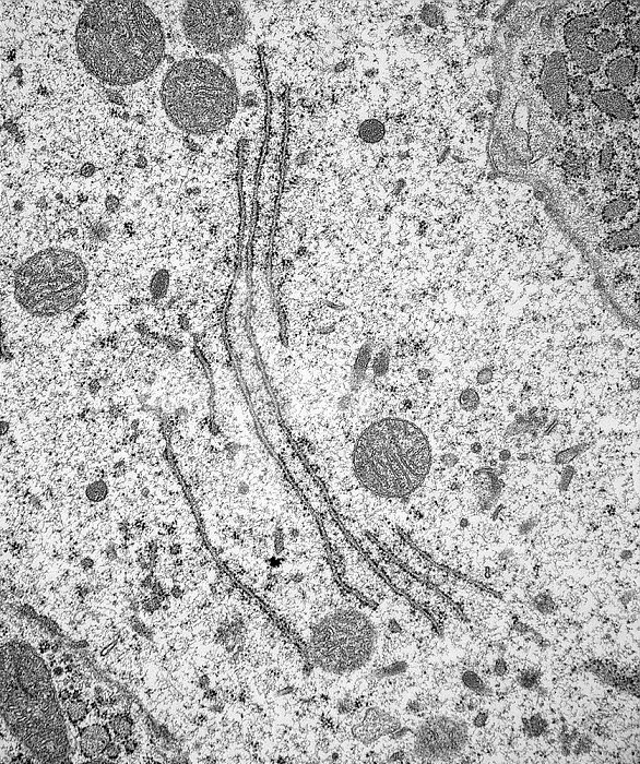 Rough endoplasmic reticulum ,RER, and mitochondria in a human jejunum cell. TEM X35,800 ,at 7.3 inches,