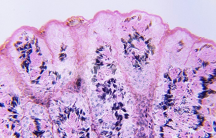 Cross-section of a Frog (Rana) testis. LM X65.