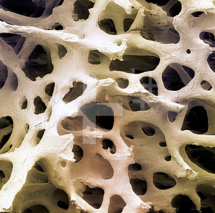 Human femur cancellous, trabecular, or spongy bone. SEM X26