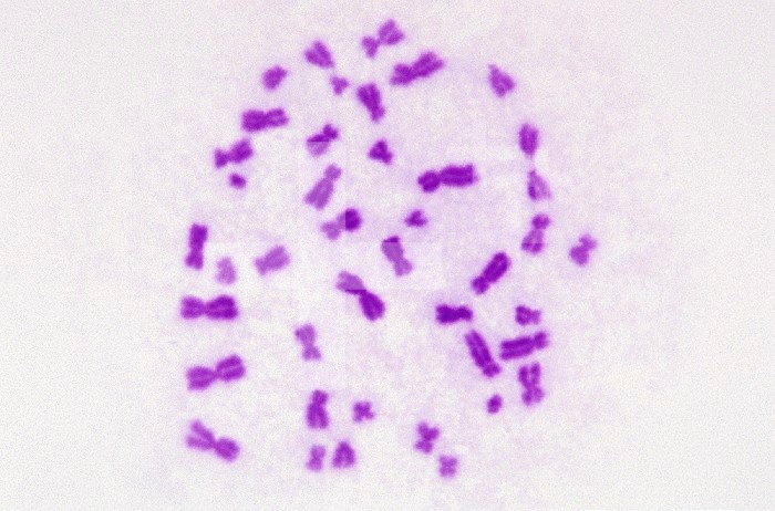 Human male chromosome spread. LM X400.