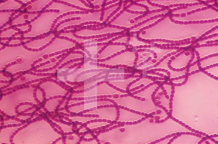 Nostoc Cyanobacteria with heterocysts. LM X250.
