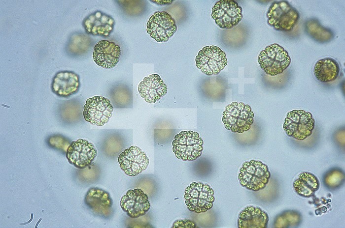 Sphaerocystis Cyanobacteria. LM X450.