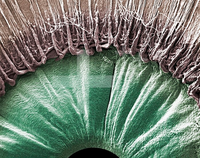 The human eye viewed from inside, showing the pupil, the ciliary body, and the edge of the pupil. SEM X35.