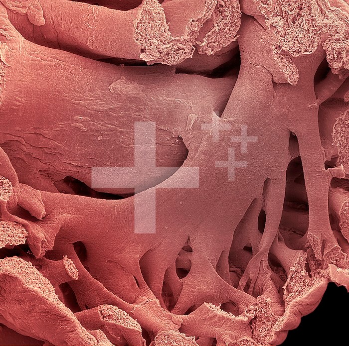 Inside of the atrium of the human heart showing pectinate muscles. SEM X24.