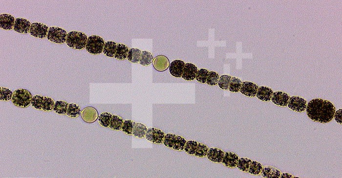 Anabaena, an unbranched, common, typically planktonic blue green alga that forms heterocysts and akinetes.