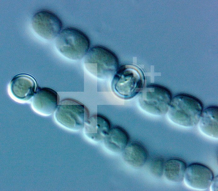Cylindrospermum, an unbranched filament consisting of rectangular cells and a basal heterocyst. This Cyanobacterium is known to absorb atmospheric nitrogen.