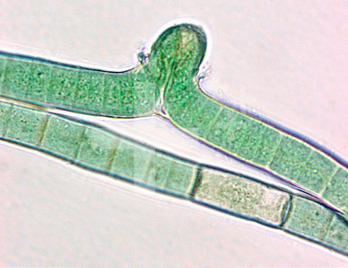 Scytonema, a false branching Cyanobacteria. LM.