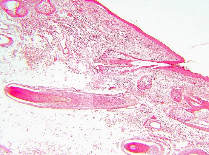 Cross-section of human skin with a hair follicle. LM.