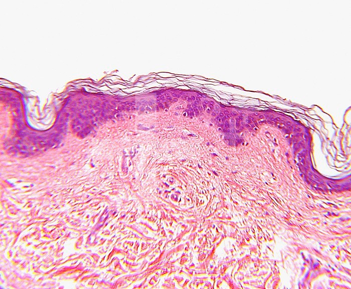 Cross-section of Caucasian human skin. LM X100. 