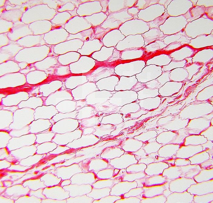 Adipose tissue in the hypodermis of human skin. LM. 