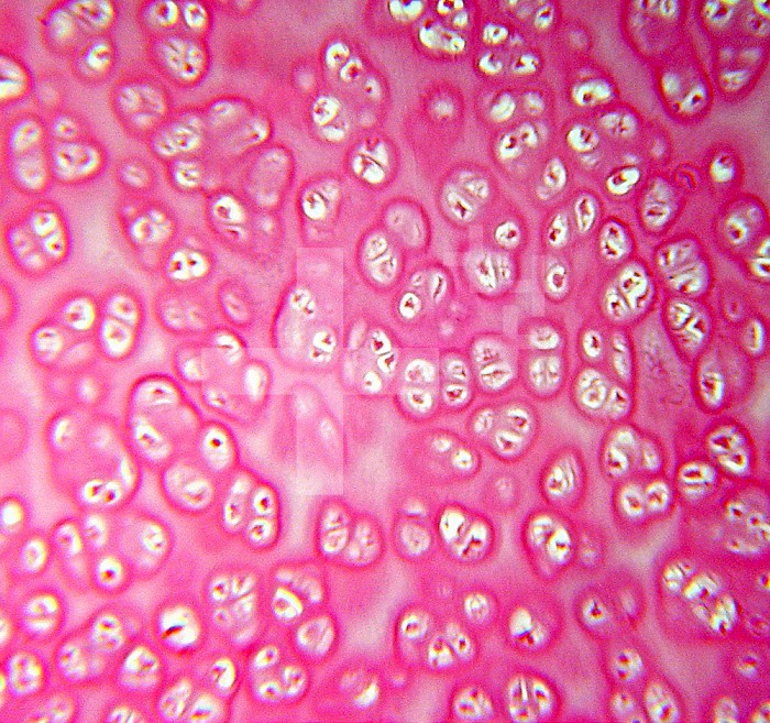 Hyaline cartilage from the human larynx. LM X160.