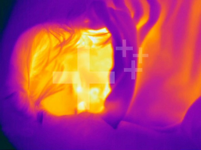 Thermogram - Child asleep - covered with blanket - The colors show temperature variation.  The temperature scale runs from white ,warmest, through yellow, orange, red, purple and black ,coldest,