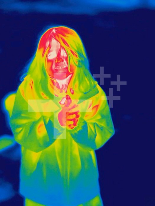 Thermogram - Child rubbing hands together - The colors show temperature variation. The temperature scale runs from white (warmest) through red, yellow, green and cyan, blue and black (coldest)