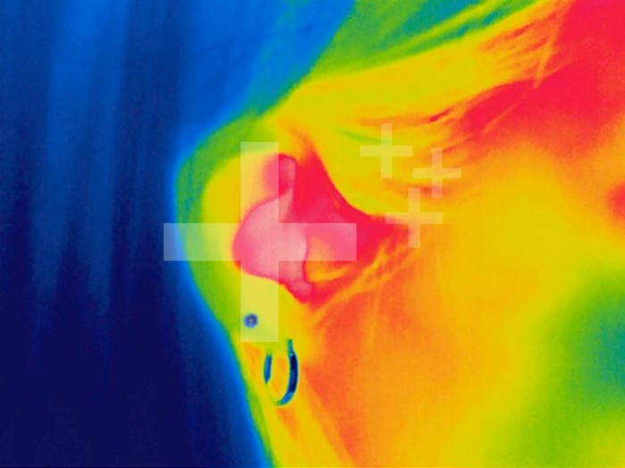 Thermogram of an adult female's ear. The colors show temperature variation with the temperature scale running from white (warmest) through red, yellow, green and cyan, blue and black (coldest).