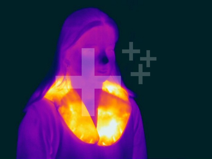 Thermogram - Female with heated neck wrap - The colors show temperature variation. The temperature scale runs from white (warmest) through yellow, orange, red, purple and black (coldest)