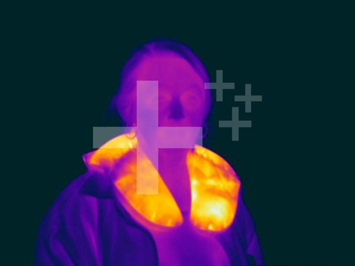 Thermogram of an adult female wearing a heated neck wrap. The colors show temperature variation with the temperature scale runing from white (warmest) through yellow, orange, red, purple and black (coldest).