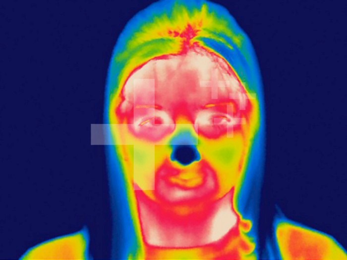 Thermogram - Adult female's face - The colors show temperature variation. The temperature scale runs from white (warmest) through red, yellow, green and cyan, blue and black (coldest)