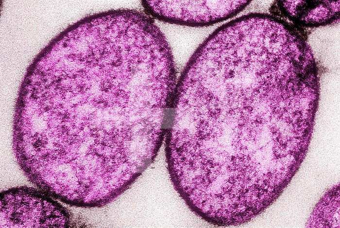 Cross-section of Mycoplasma bacteria, a common cause of atypical pneumonia. This bacteria is unusual in that it lacks a cell wall. TEM X95,000.