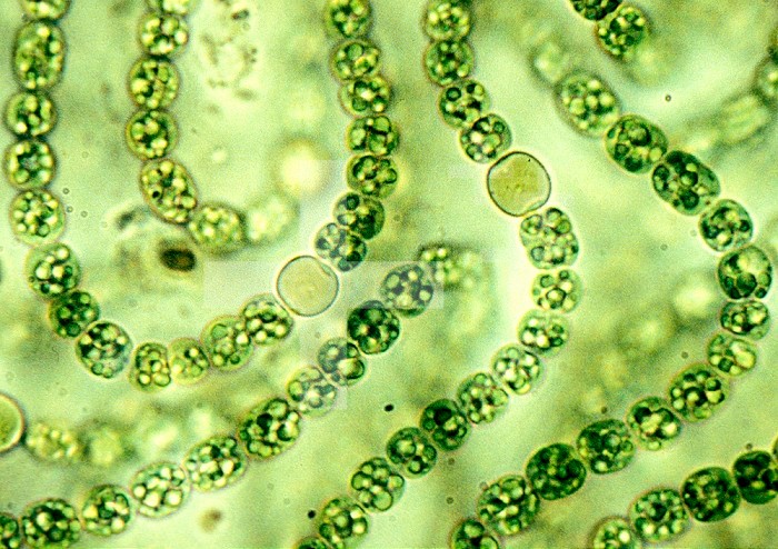 Nostoc Cyanobacteria, with heterocysts important in nitrogen fixation. LM X1000