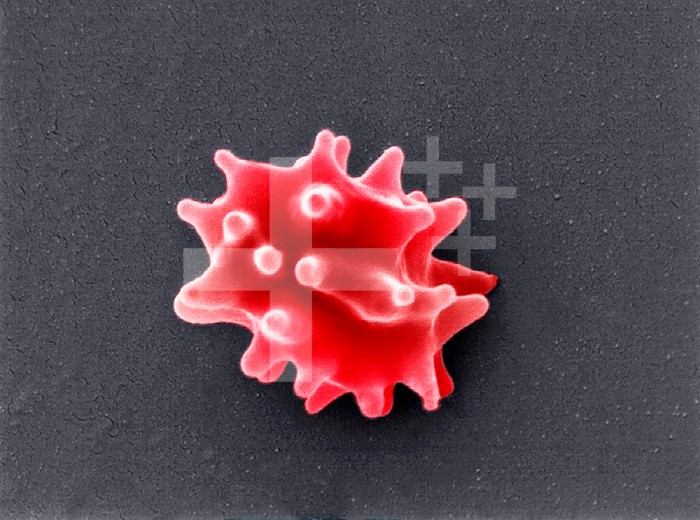A crenated red blood cell or erythrocyte resulting from exposure to a hypertonic solution. ,Compare this view with 349574 and 195904,. SEM X14,000.