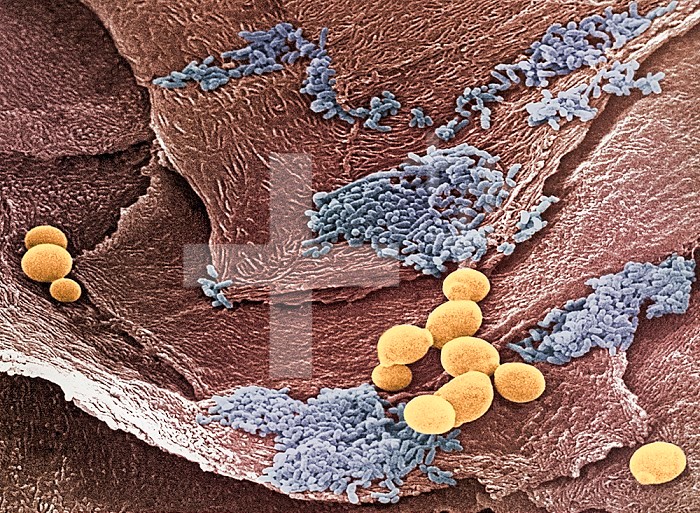 Yeast ,Candida albicans, on vaginal epithelium. Other bacteria colorized blue is also visible. SEM X7000  Yeast is a symbiotic organism that is part of the healthy human flora. Under certain conditions it can thrive and an overgrowth occurs. When this happens a female may experience symptoms of vaginitis and a male may experience jock itch.