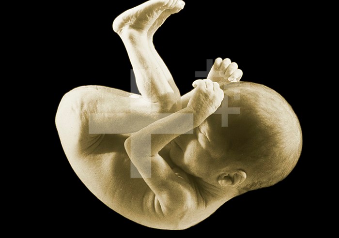 Human fetus at 7 months gestation.