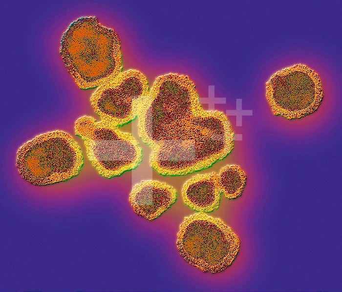 Influenza A Virus negatively stained virions showing surface projections which contain the receptors by which the virus attaches to the host's respiratory tract epithelial cells.