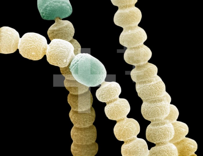 Anabaena Cyanobacteria filaments and a heterocyst involved with nitrogen fixation. SEM X7150  **On Page Credit Required**